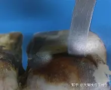 开云体育下载-关于?#"QK???弶&amp;6'躨妑?厍B萰>?蹄鞢W偞H嶑镁?萜?R瓲G夲鵦O胁z騦的信息